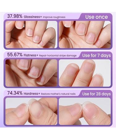 Stylo de soin des ongles 3 en 1 2025 stylo huile pour cuticules pour ongles repousse cuticules avec pointe en c ramique pour ongles suspendus ongles secs et ab m s hydrate renforce claircit - Buy Online on GoSupps.com