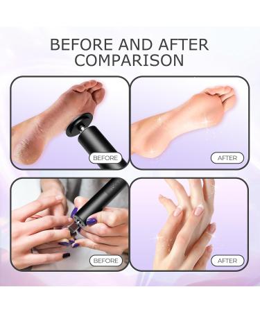 Arofaue Electric Callus Remover Kit USB Rechargeable Electric Foot File 2 in 1 Foot Scrubber Dead Skin 6 Gears Electric Nail Buffer Set for Daily Care Grinder Nail Polish Men & Women Black Electric Callus Remover Kit Black - Buy Online on GoSupps.com