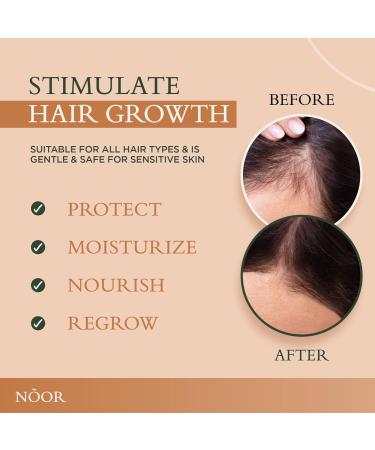 NOOR HAIR Growth Super Serum | Treat Frizzy & Damaged Hair Prevent Hair Loss & Thinning - Best Hair Treatment for Women - Buy Online on GoSupps.com