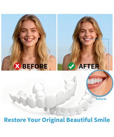 Smilify Custom-Fit Cosmetic Teeth Covers for Women and Men Personalized Clip-on Smile Accessory DIY Fitting Set - Removable Temporary Smile Enhance Prop - Buy Online on GoSupps.com