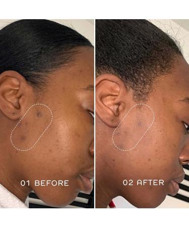 REN Dark Spot Overnight Cream - Hyperpigmentation & Acne Scar Remover - 1.7 Fl oz - Buy Online on GoSupps.com