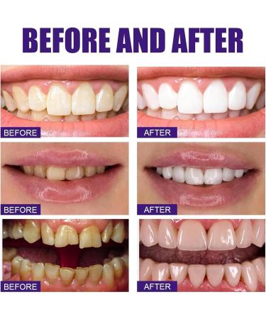 50g Tooth Powder Teeth Whitening Powder Probiotics Dazzling White Tooth Powder Natural Teeth Whitening Powder Stain Removal - Buy Online on GoSupps.com