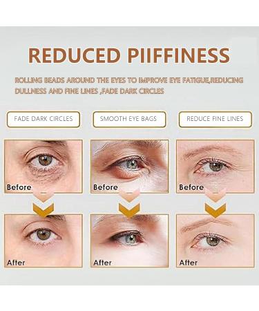 Buy Time Eraser Oil & Roller Ball - Organic Castor Oil & Frankincense for Eye Bags Fine Lines Anti-Wrinkle (2pcs) - International Shipping Available - Buy Online on GoSupps.com
