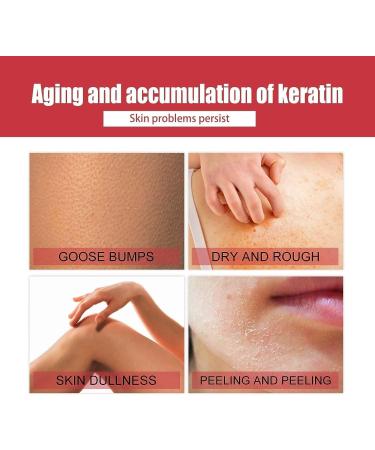  1/2/3Pcs B-Glossy Smoothing Body Serum Body Smoothing Serum for Silky Smooth Skin Smoothing Body Serum for Body Shaping and Cellulite Reduction Deep Moisturising Cream for Dry Heavy Body Skin Care 100ml/3.38fl.oz (2Count (Pack of 2)) - Buy Online on GoSupps.com