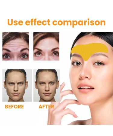 Forehead Wrinkle Remover Patch - Smooth Lines & Lift Skin with Hydrolyzed Collagen & Centella Asiatica - Buy Online on GoSupps.com