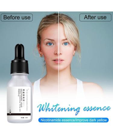 Nicotinamide Brightening Face Serum with Aloe Vera Extract - Anti-Aging, Moisturizing, and Pore Minimizing Formula for Dry Skin and Dark Spots (1PC) - Buy Online on GoSupps.com
