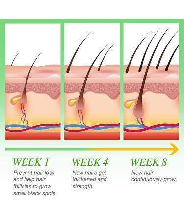 Rice Water Hair Growth Oil - Natural Moisturizer & Conditioner for Stronger, Thicker, Longer Hair - 2.02 fl.oz - Buy Online on GoSupps.com