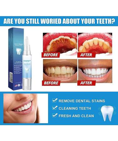 Dentiz Gum Protection Therapy Gel & Tooth Whitening Pencil - Rejuvenate Gums & Treat Recessions (2PC) - International Shipping - Buy Online on GoSupps.com