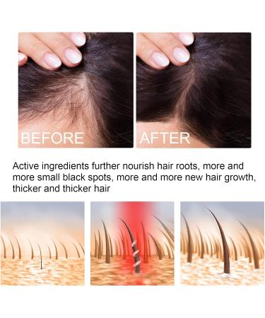 Saksraar Hair Growth Essential Oil Saksraar S rum de Croissance de Cheveux Huile De Repousse des Cheveux Au Gingembre S rum anti-chute de cheveux Perte de Cheveux et Cheveux Effiler Traitement - Buy Online on GoSupps.com