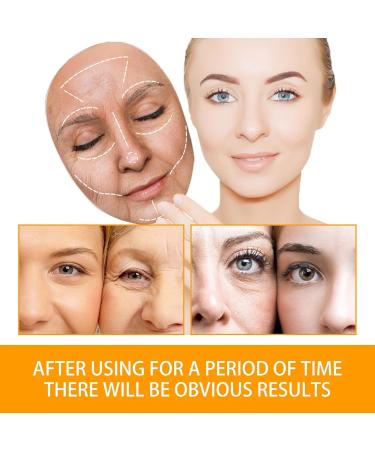 Vitamin C Face Cream-Face Moisturiser For Women-Day & Night Anti Wrinkle Face Cream With Vitamine & Hyaluronic Acid Hydrate Anti Aging Hydrate Reduce Dark Circles Boost Skin Collagen 30g - Buy Online on GoSupps.com