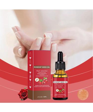  Generisch Rosehip Oil 30 ml Natural Organic Chicken Oil | Nourishing and Moisturizing Carrier Oil | Seed Oil for Face Skin Body Hair Hands etc. - Buy Online on GoSupps.com