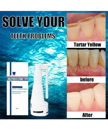 Mouth Shower Test Winner | Calculus-Free Deep Cleaning Foam & Stain Removal Tooth Spray - 30ml White - Buy Online on GoSupps.com
