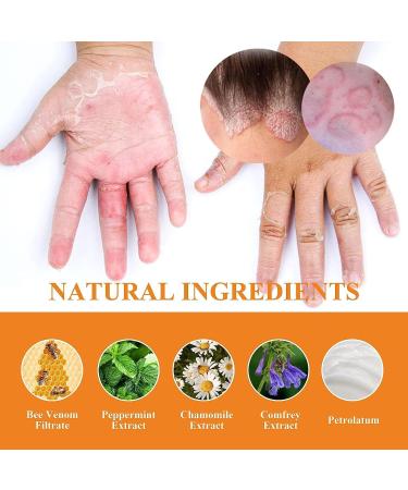 HEKEWER Youth Bee Venom Psoriasis Treatment Cream - Soothing Moisturizing Formula for All Skin Types - Buy Online on GoSupps.com