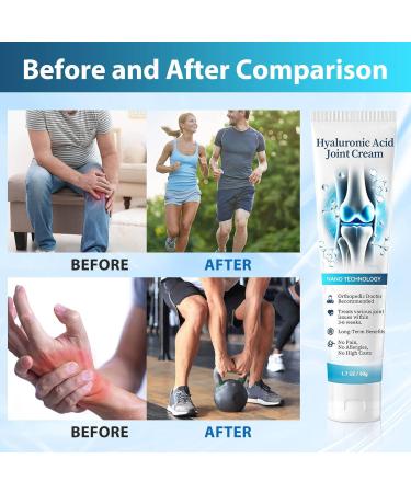 Hyaluronic Acid Joint Cream Joint Pain Cream Joint Relief Cream Turmeric Joint Bone Pain Relief Cream Joint Ease Hyaluronic Acid Joint Cream Joint Repair Cream 1 Piece 50g 1er Pack - Buy Online on GoSupps.com