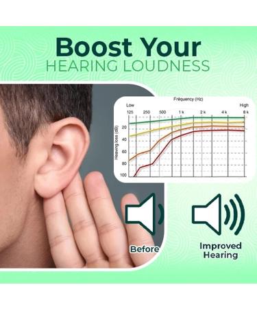 Green Tinnitus Relief Ear Plugs 30g - Small Size for Sleeping - Ear Care Soothing Solution - Buy Online on GoSupps.com