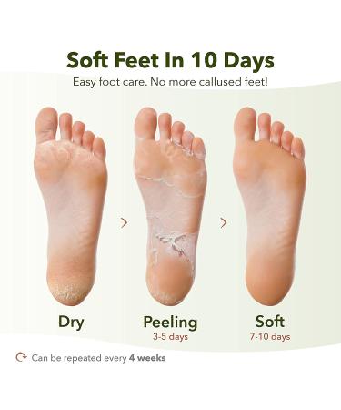 PURDERM Shiny & Soft Foot Peeling Mask (6 Pack) - Exfoliating Treatment for Cracked, Dry, Callused Feet - Removes Dead Skin & Reveals Baby Soft, Smooth Skin - Lemon & Natural Botanical Extracts - Buy Online on GoSupps.com