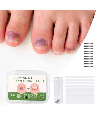 Jubilofex Toenail Correction Plaster 10 Pieces Correction Plaster for Ingrown Nails Repairing Plasters for Nighttime Use for Adults 14 mm - Buy Online on GoSupps.com