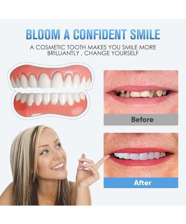 2 PCS Fake Dentures Teeth for Women and Men - Dental Veneers for Temporary Teeth Restoration - Natural and Comfortable - Restore Your Smile with Confidence - Natural Shade - Buy Online on GoSupps.com