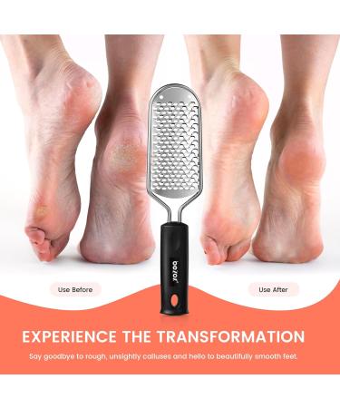 BEZOX Foot Scrubber - Stainless Steel Callus Remover for Smooth Feet | Effective Dead Skin Rasp - International Shipping Available - Buy Online on GoSupps.com
