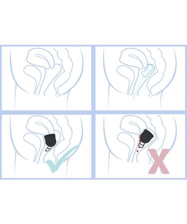 Merula Cup XL Midnight (Black) - Optimal Menstrual Cup for Heavy Flow Days | Shop Internationally - Buy Online on GoSupps.com