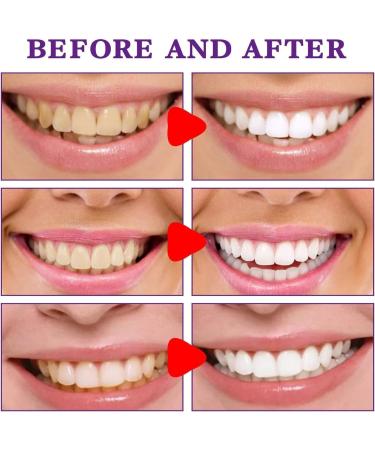 SP-8 Ultra Whitening Toothpaste 2PCS | Brightening & Stain Removing Formula for Fresh Breath | International Shipping Available - Buy Online on GoSupps.com