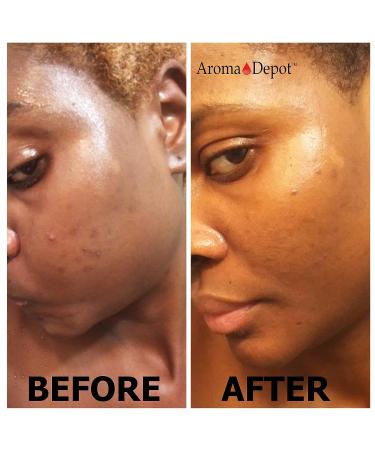 Aroma Depot Raw African Liquid Black Soap - 100% Natural for Acne, Eczema, Psoriasis - Handmade from Ghana - Gallon Size - Buy Online on GoSupps.com