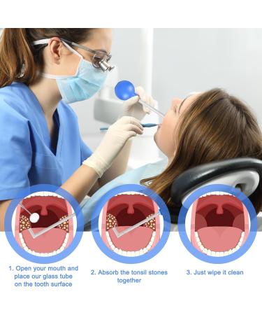 Buy Mhduyeg Tonsillenstein - Effective Almond Stones Cupping Glass for Fresh Breath & Tonsil Stone Removal - Buy Online on GoSupps.com