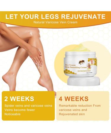 Bienergiftsalbe - Varicose Veins & Spider Veins Relief Cream | Bee Venom Leg Pain & Swelling Treatment (2 Pieces) - Fast International Shipping - Buy Online on GoSupps.com