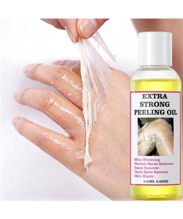 Extra Strong Yellow Peeling Oil Yellow Peeling Oil Extra Strong Peeling Oil for Dark Skin Extra Strong Peeling Oil Extra Strength Exfoliating Peeling Solution for Body Dead Skin Remover (3PC) - Buy Online on GoSupps.com