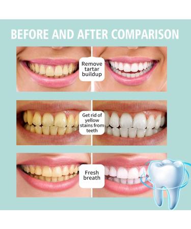 Dental Mouthwash Herbal Whitening Oral Repair Foam Deep Cleaning Deep Clean Fresh Breath - Buy Online on GoSupps.com