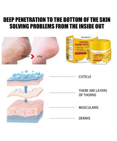 YUECI Moisturizing Horneut Care | Banana Repair Balm Foot Cream & Toe Nail Treatment - Repair Cracked Heels & Deep Moisturize - Size A - Buy Online on GoSupps.com
