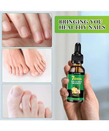 KERANEET Ginger Nail Care Nail Care Nail Repair Ginger Cuticle Care Oil for fragile nails protection to strengthen the nail treatment nail care ginger - Buy Online on GoSupps.com