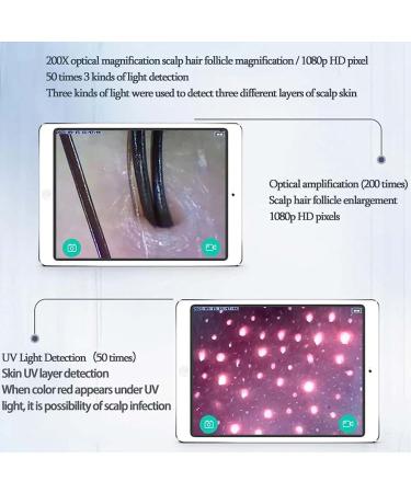 Buy Skin Hair Analyser - 5 in 1 WiFi Scalp Detector | 50x/200x Magnifying Portable Scanner for Hair Follicle & Skin Pigment Testing - International Shipping Available - Buy Online on GoSupps.com