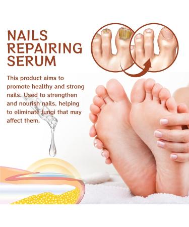 GFOUK 7 days Nail Growth and Strengthening Serum for Thin Nails Nail Growth and Strength Serum Nail Cuticle Oil Strengthener Stronger Nails in 1 Week Nail Strengthening Treatment (2 pcs) - Buy Online on GoSupps.com