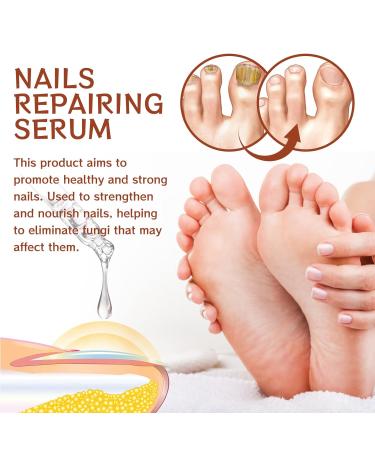 GFOUK 7 Days Nail Growth and Strength Serum Set - Nail Repair and Growth Oil for Toenail Treatment (2 Pcs) - Buy Online on GoSupps.com