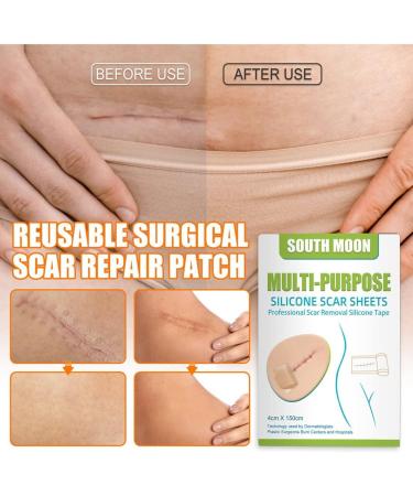 Silicone Scar Gel Strip - Efficient Scar Treatment for Surgery, Acne & Trauma - 4 * 150cm - Buy Online on GoSupps.com