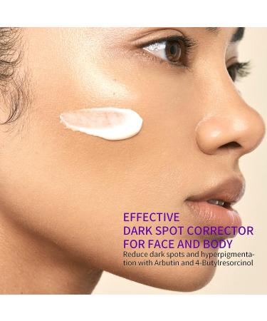 ASHEPANX Dark Spot Remover Cream for Face and Body - Melasma & Hyperpigmentation Treatment | Brightening & Moisturizing Formula | Age Spot & Sun Spot Corrector - Instant Results - Buy Online on GoSupps.com