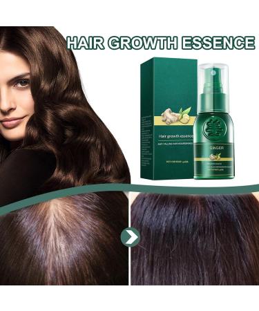 Joyivike 2 Hair Oil Mist Ginger Oil 30ML Hair Oil Mist Grows Hair Thicker Longer Accelerates Hair Growth for Men - Buy Online on GoSupps.com