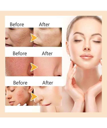 Freeze Dried Collagen for Face Freeze-Dried Nano Silk Anti-Wrinkle Repairing Serum Set Instant Faces and Eye Lift Anti-Aging Face Ampoule for Elasticity Care (2Set) - Buy Online on GoSupps.com