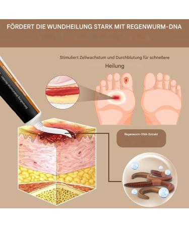  Generisch Cream for dry feet - 30g naturally moisturizing and soothing | Skin care for cracked feet and heels for daily use nighttime travel women - Buy Online on GoSupps.com