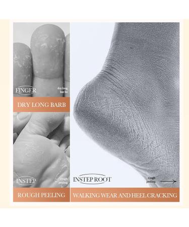 Cracked Heel Repair Cream For Feet and Hand Foot Cream Athletes Foot cream Foot Cream for Dry Skin Deep Moisturizing Callus Remover & Soften Hard Skin Callus Remover Hard Skin Remover Foot Cream - Buy Online on GoSupps.com