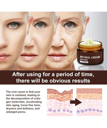 Anti-Wrinkle Face & Neck Retinol Cream with Hyaluronic Acid - Premium Anti-Aging Face Moisturizer - Anti Aging Firming Facial Cream to Reduce Wrinkles Dark Spots Fine Lines Sun Damage - Buy Online on GoSupps.com