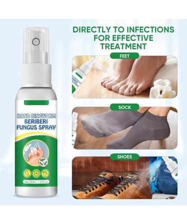 Extra Strength Athletes Foot Treatment Spray for Itchy, Inflamed, and Smelly Feet - 30ML (1FL.OZ) - Buy Online on GoSupps.com