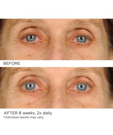 NassifMD Under Eye Smoother - Anti Aging Eye Cream for Dark Circles & Puffiness Firming Eye Serum for Women - Buy Online on GoSupps.com
