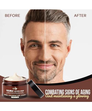 Mens Face Moisturizer Cream - Anti Aging Wrinkle Face Cream - Mens Facial Moisturizer - Retinol Collagen Vitamin E | Day & Night | Eye Bags & Dark Spot Corrector Cream | Made in USA | 30g - Buy Online on GoSupps.com