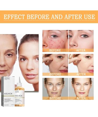 Glycolic Acid 7% Toner Glycolic Acid Toner for Face Repair Acne & Anti Aging Face Toner - Brightening & Facial Exfoliation Prevent Skin AgingImprove Blemishes Astringe Pores 1# - Buy Online on GoSupps.com