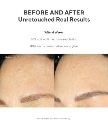 Murad Resurgence Retinol Youth Renewal Serum: Anti-Aging Firming Face & Eye Cream for Fine Lines & Wrinkles - Retinol Tri-Active Technology for All Skin Types - Buy Online on GoSupps.com