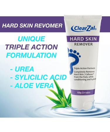 Clearzal Foot Cream for Hard Skin - Callus and Corn Removal, Hydrating Triple Action Formula with Aloe Vera - 3.4oz - Buy Online on GoSupps.com
