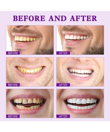 SP-7 Natural Tooth Whitening Toothpaste | Stain Removal & Fresh Breath (3 Pieces) - Deep Cleaning for Gums - Buy Online on GoSupps.com