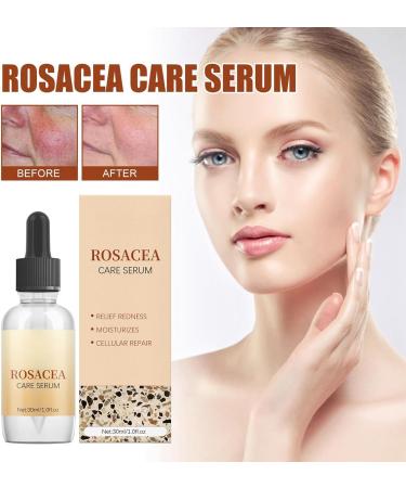 Rosacea Face Serum Anti Redness Face Serum for Women Relieve Redness & Acne Mark Dark Spot Correcting Glow Serum Anti Aging Serum for Face Hydrating Face Serum Skin Care for Women Dark Spots Remover - Buy Online on GoSupps.com